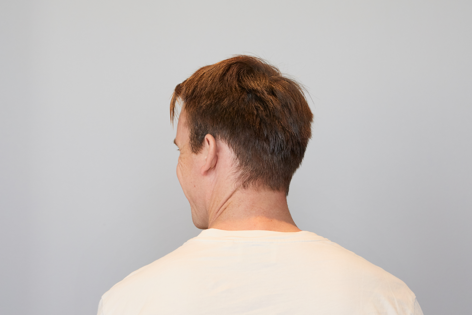 Masterklinikken Etter Behandling