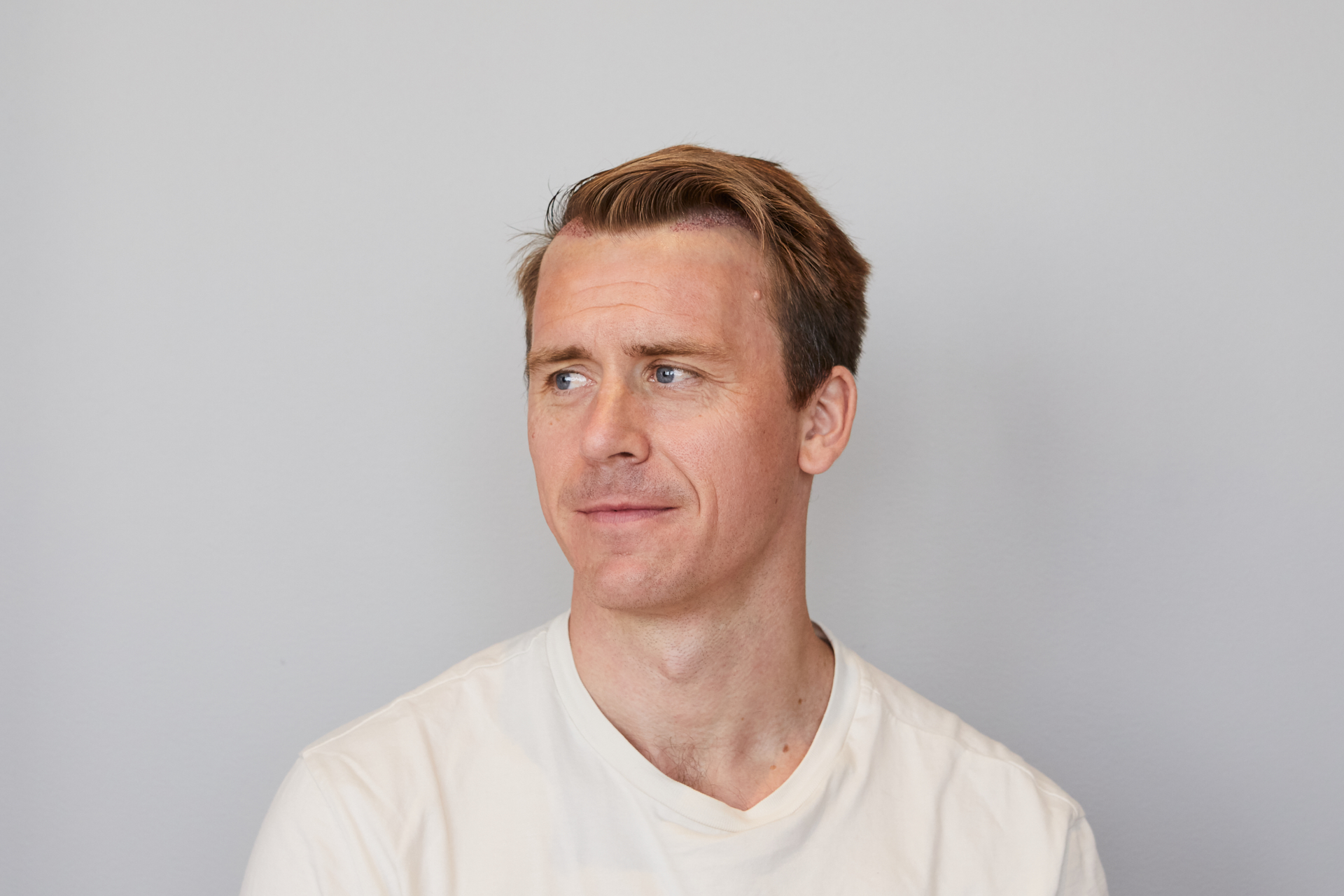 Masterklinikken Etter Behandling Viker Nonshave